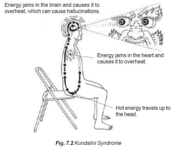 Kundalini Syndrome